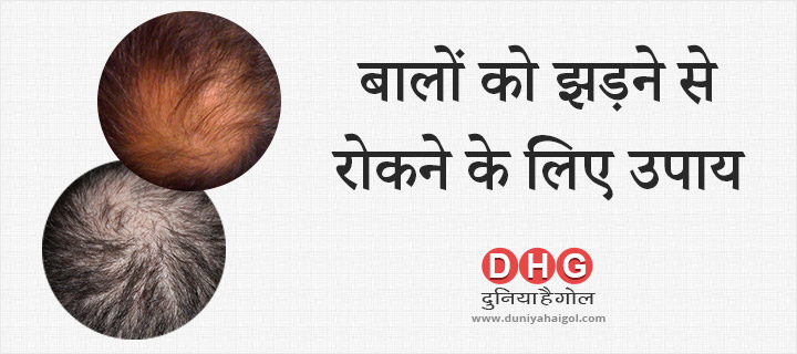 Tips to Prevent Hair fall & Hair loss in Hindi | बालों को झड़ने से रोकने के  लिए उपाय